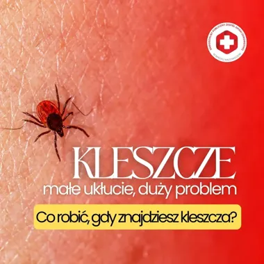 Kleszcze już atakują. Groźne choroby nie kończą się na boreliozie